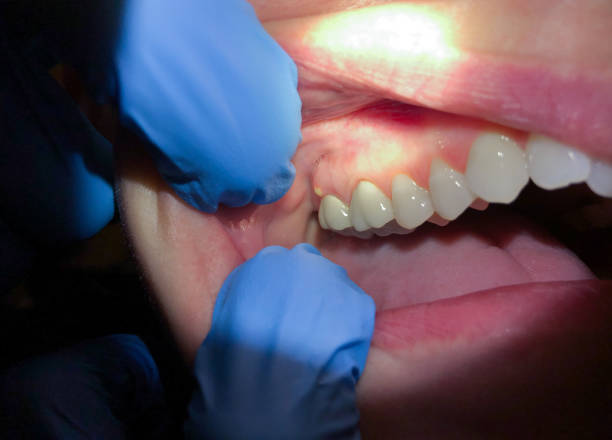 Best Urgent Care for Lost Fillings or Crowns in Del Rio, TX